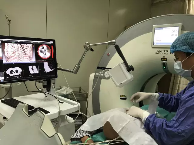 IQQA-Guide三維影像術中導航系統(tǒng)獲創(chuàng)新醫(yī)械特別審批，推動精準醫(yī)療新發(fā)展